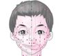 丝竹空穴后.tif