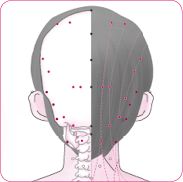 天柱穴后.tif