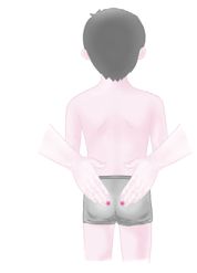 7-会阳穴000.tif