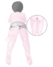 13-长强穴.tif