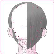 哑门穴后.tif
